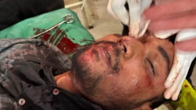 सड़क पर रोककर जानलेवा हमला, युवक गंभीर रूप से घायल, सिर पर आई गहरी चोट, आरोपियों पर मामूली धाराओं में FIR चौथा स्तंभ || Console Corptech