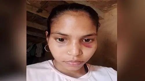 प्रेम विवाह के बाद 5 माह की गर्भवती पत्नी की हत्या, शव बोरे में भरकर खेत में फेंका; दहेज हत्या का केस दर्ज 1 प्रेम विवाह के बाद 5 माह की गर्भवती पत्नी की हत्या, शव बोरे में भरकर खेत में फेंका; दहेज हत्या का केस दर्ज चौथा स्तंभ || Console Corptech
